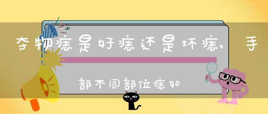 夺物痣是好痣还是坏痣,手部不同部位痣如何分析