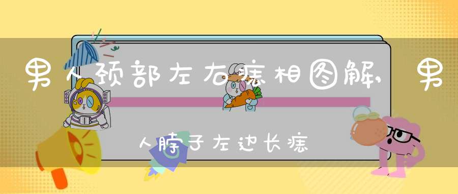 男人颈部左右痣相图解,男人脖子左边长痣容易破财